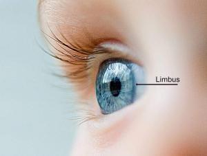 Limbus